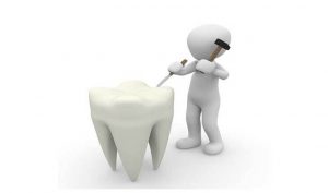 Funny Teeth Sayings